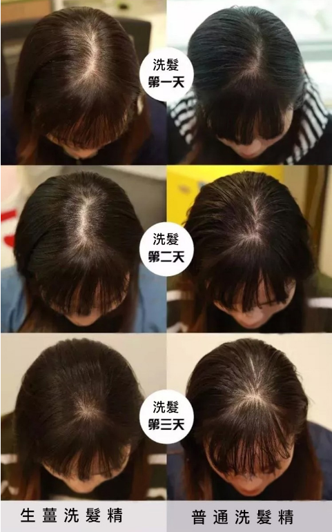 生薑養髮洗鬢乳,溫和無刺激 促進頭皮的血液循環,用它洗頭 頭鬟暴增 濃密黑亮 頭鬢更加滋潤保濕有光澤 生薑養髮洗鬢乳,溫和無刺激 促進頭皮的血液循環,用它洗頭 頭鬟暴增 濃密黑亮 頭鬢更加滋潤保濕有光澤