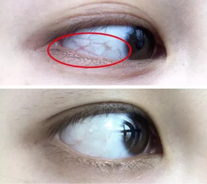 1754513522489220.jpg d8df3ac8ccd81b15d658bbcb53be5d5c.jpg